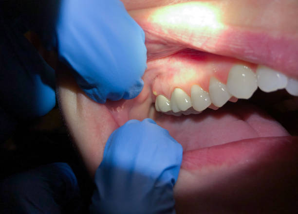 Best Weekend Emergency Dentist in Savannah, MO