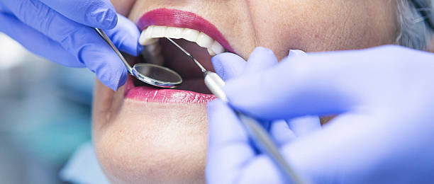 Best Broken or Cracked Tooth Emergency Dentist in Savannah, MO